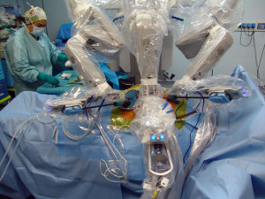 Una fase dell'intervento chirurgico di trapianto di rene con l'ausilio del  robot chirurgico Da Vinci,  eseguito nell'Azienda ospedaliera universitaria (Aoup) a Pisa. Il trapianto rene, donato da una madre di 57 anni alla figlia di 37, e' stato eseguito praticando 3 millimetriche incisioni che hanno consentito di introdurre gli strumenti robotici. A queste microincisioni se ne e' aggiunta un'altra di circa 5 cm sopra il pube, attraverso la quale e' stato introdotto il rene.      ANSA/ U.S./ DBA